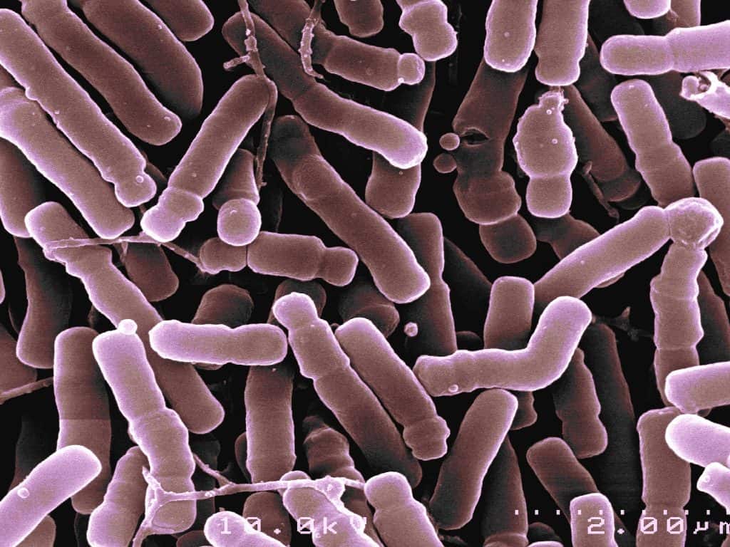 Bifidobacterium longum